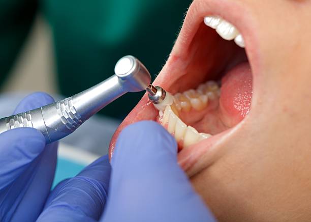 Best Root Canal Treatment  in West Concord, MA